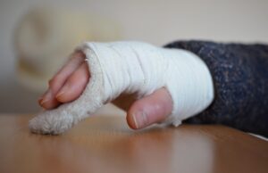 A gipszlevétel még nem a történet vége – ezért kulcsfontosságú a rehabilitáció csuklótörés után