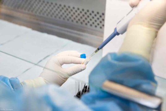 Új, erősen mutálódott Covid‑variáns terjed az Egyesült Államokban – kérdéses a jelenlegi vakcinák hatékonysága